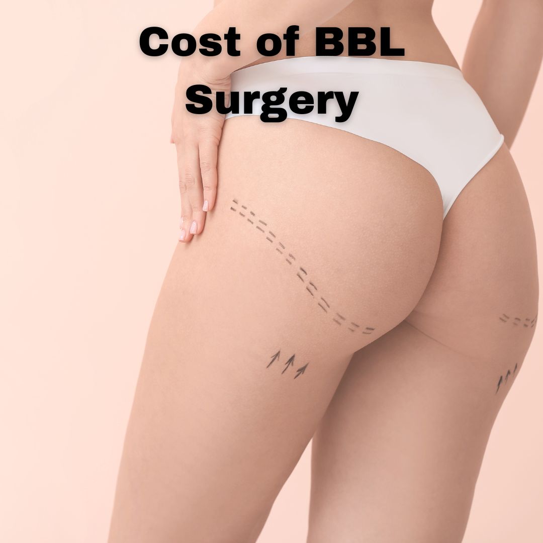 Cost of BBL Surgery