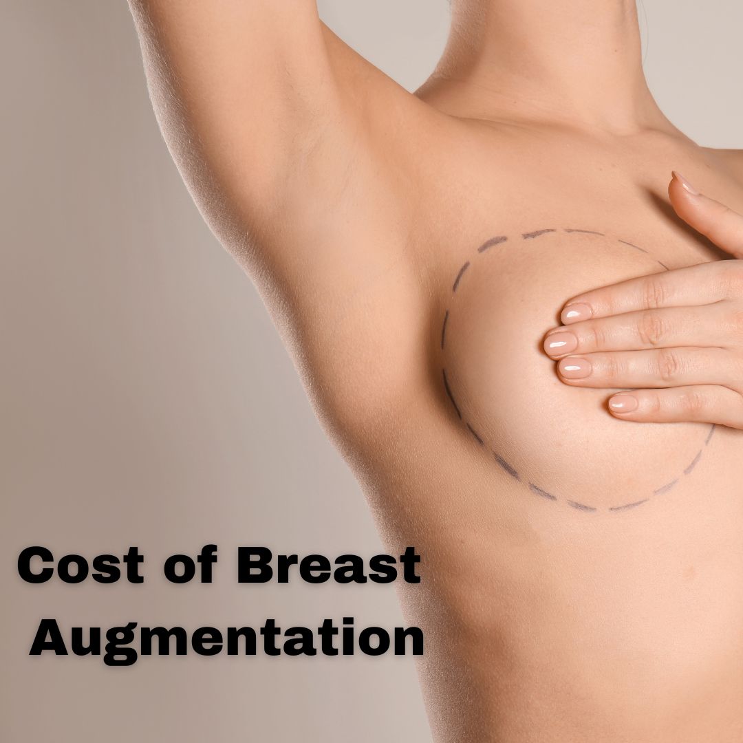 Cost of Breast Augmentation Fodor Plastic Surgery