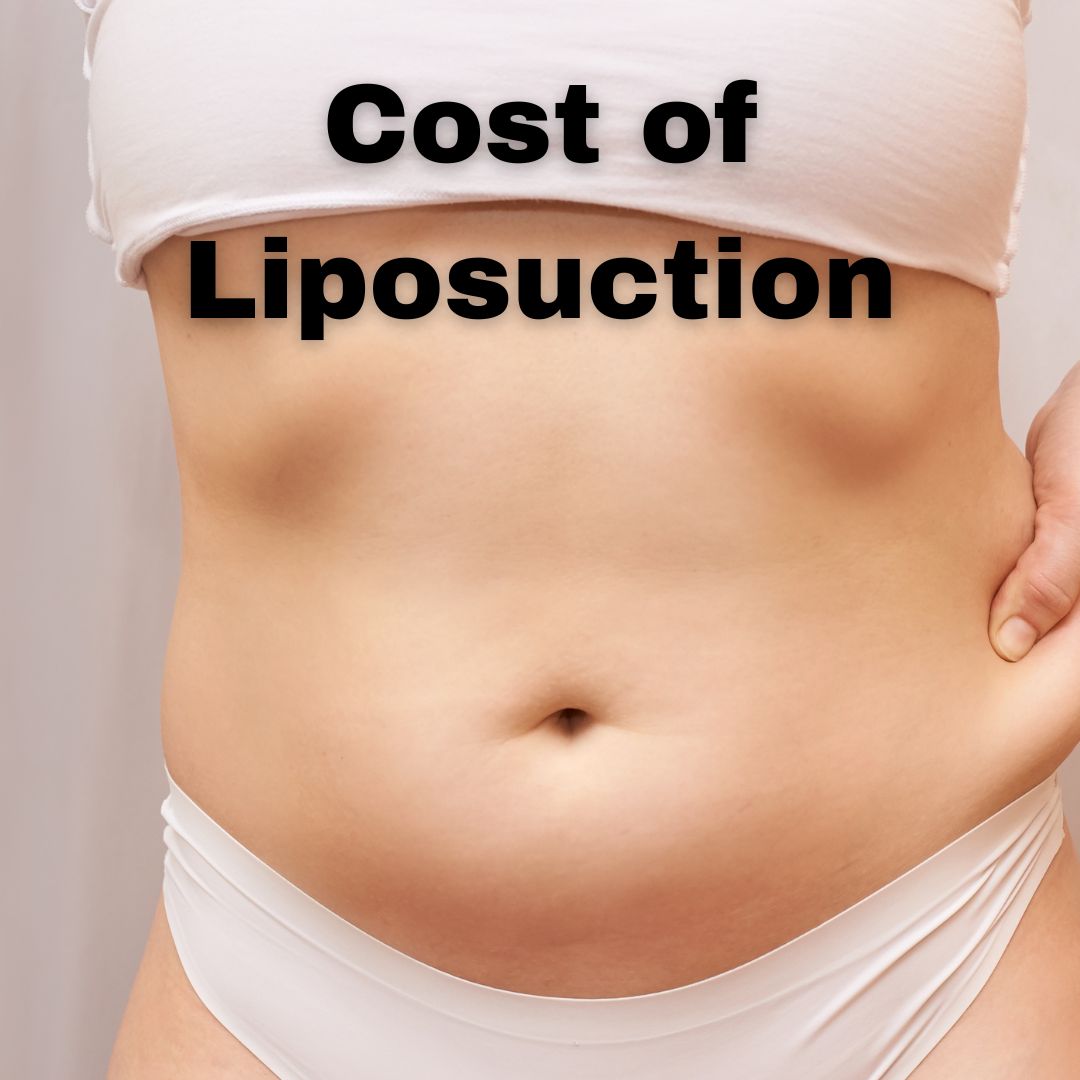 Cost Of Liposuction