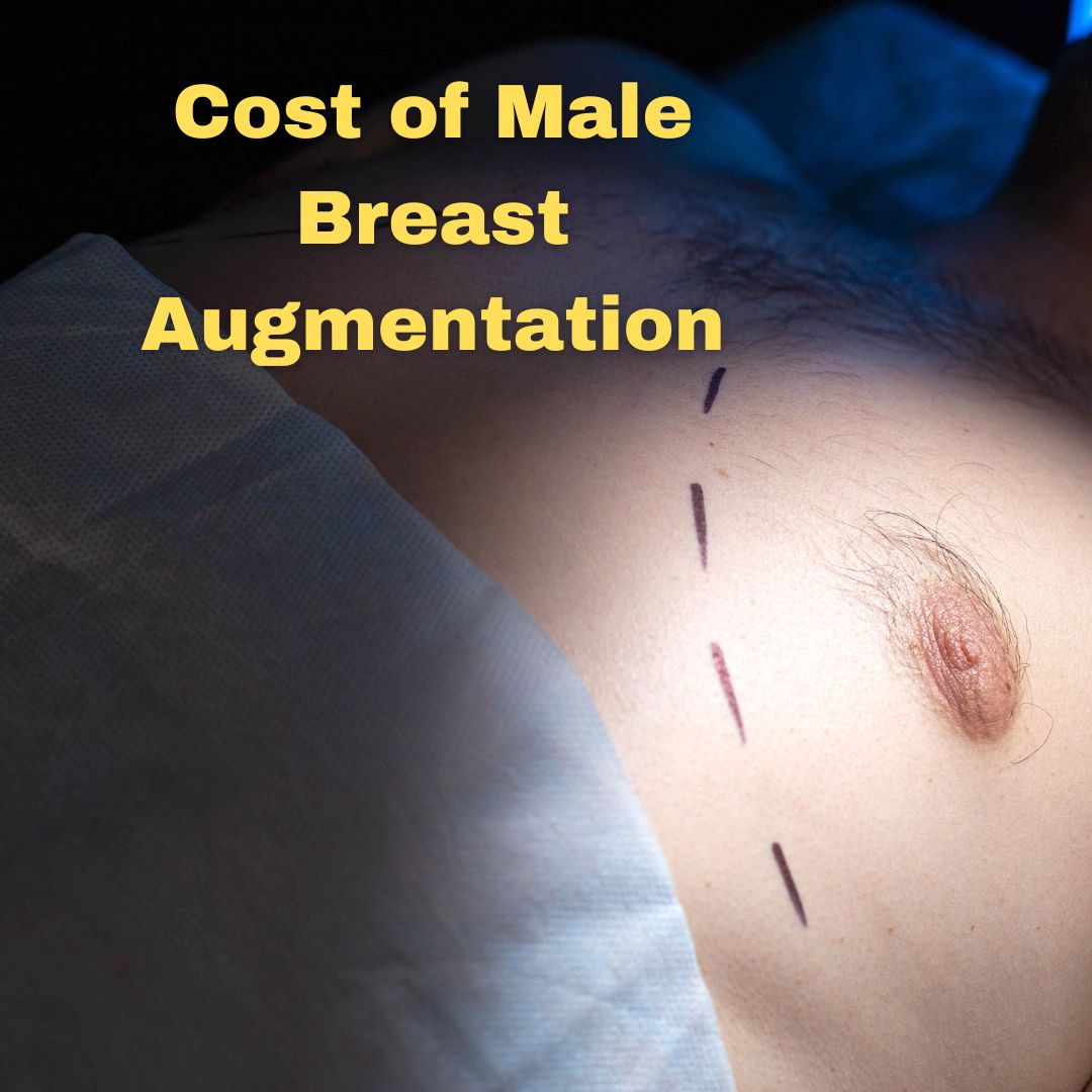 Cost of Male Breast Reduction