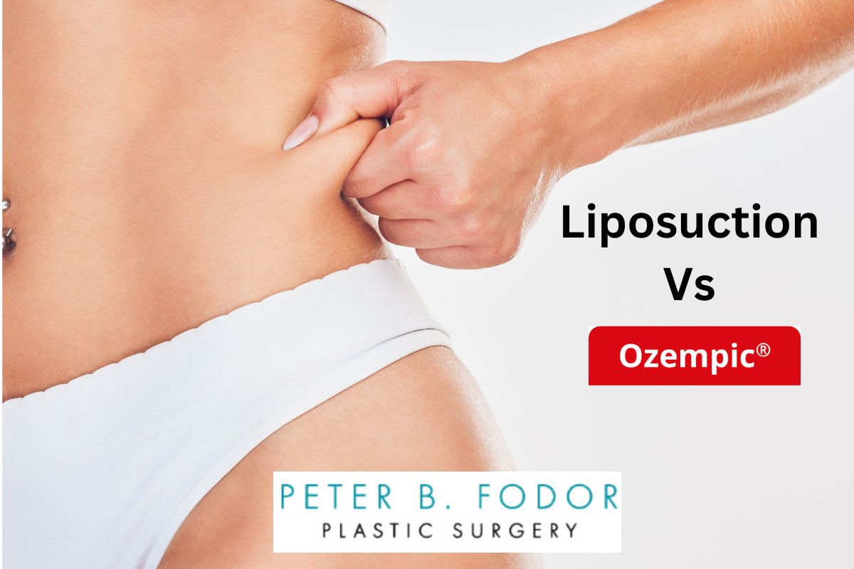 Liposuction vs. Ozempic: Understanding Your Options for Fat Reduction