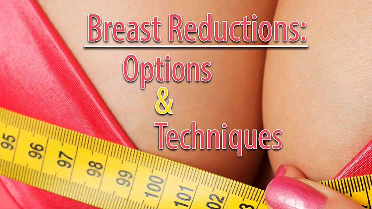 In this video, Dr. Fodor discusses breast reduction options.