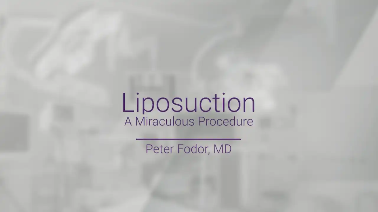 In this video, Dr. Peter Fodor discusses liposuction.