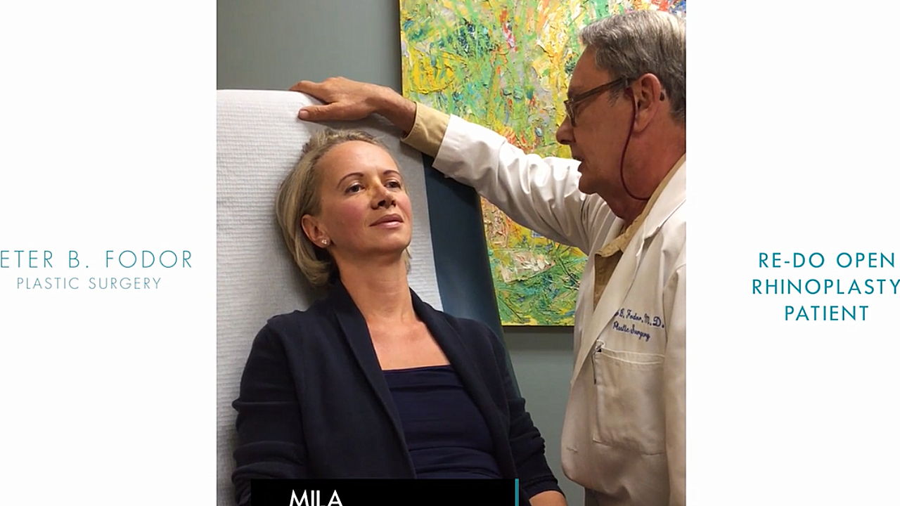 In this video, a patient discusses her revision rhinoplasty surgery with Dr. Peter B. Fodor.