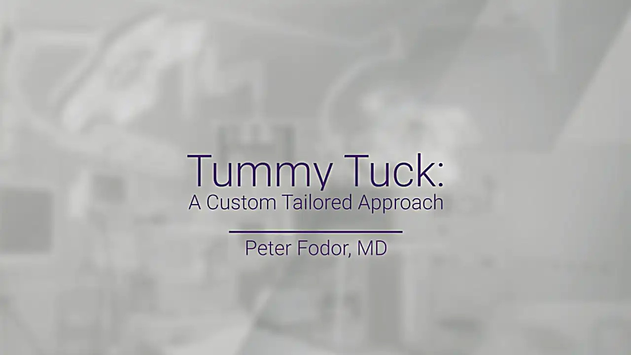 In this video, Los Angeles Plastic Surgeon discuss tummy tuck surgery.