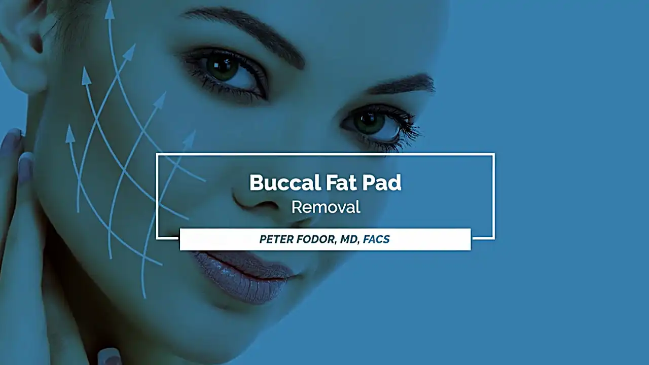 Video about buccal fat pad removal