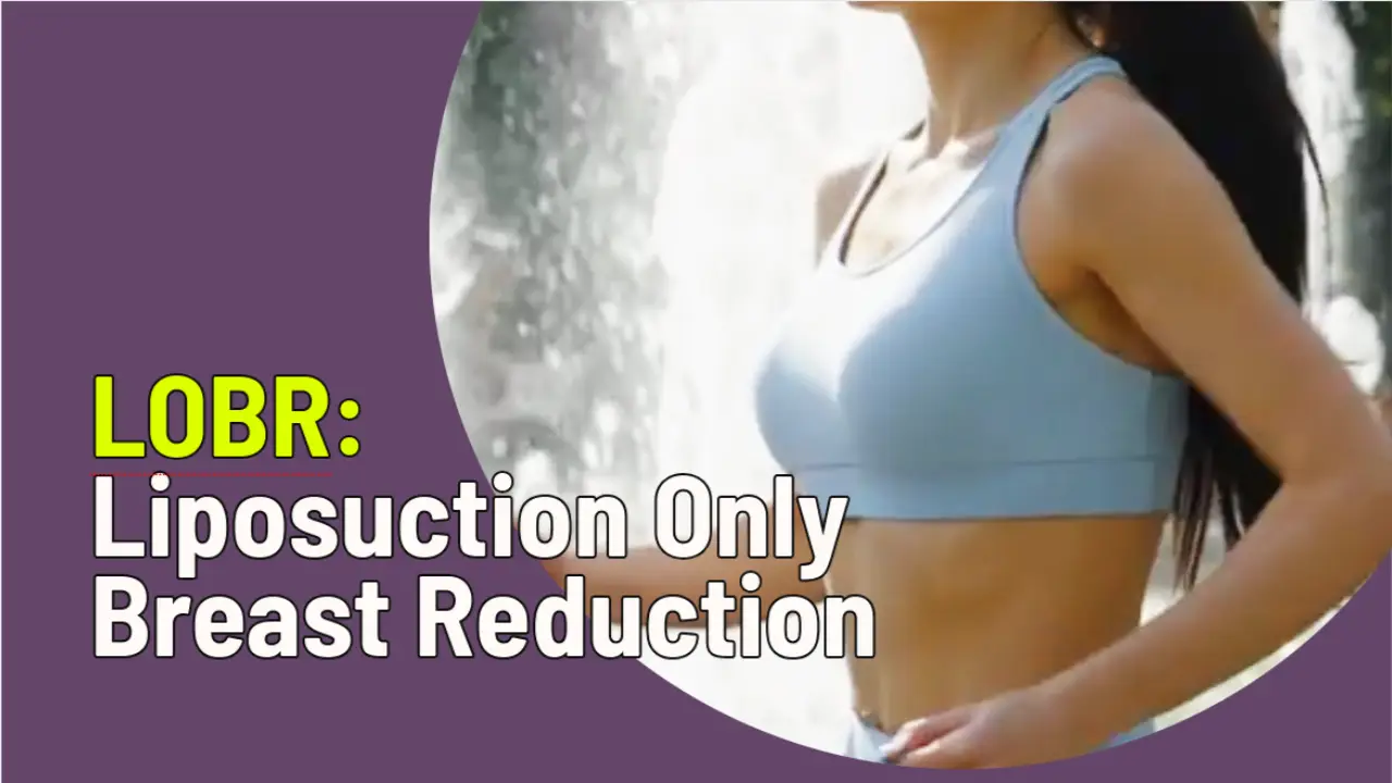 Video about Scarless Breast Reduction, also called Liposuction Only Breast Reduction, by leading Los Angeles Plastic Surgeon Dr. Peter B. Fodor